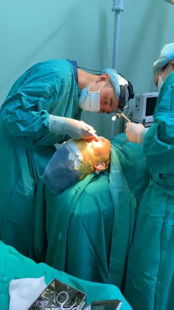 THÀNH QUẢ SAU NÂNG MŨI CẤU TRÚC + ĐỘN THÁI DƯƠNG