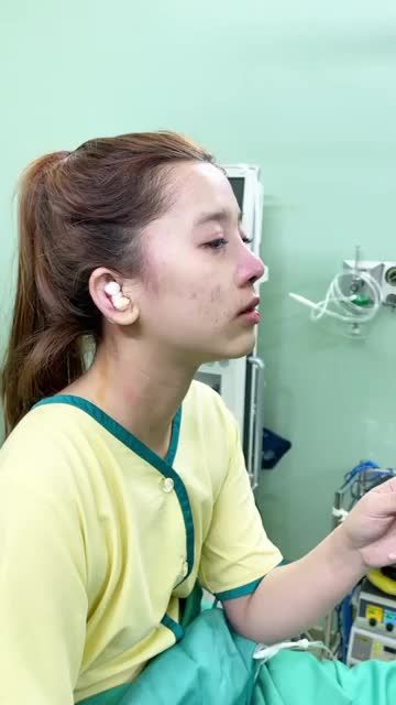 THÀNH QUẢ SAU NÂNG MŨI CẤU TRÚC S-LINE
