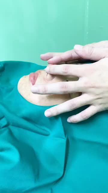 THÀNH QUẢ SAU NÂNG MŨI CẤU TRÚC SỬA LẠI