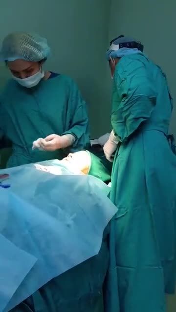 THÀNH QUẢ SAU NÂNG MŨI CẤU TRÚC TẠI MEDIKA