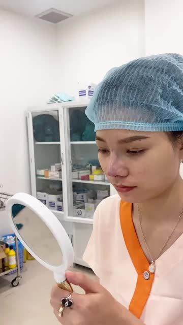 Thay đổi 90% sau nâng mũi cấu trúc