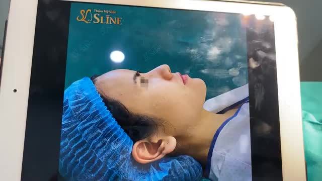THAY ĐỔI DÁNG MŨI THAY ĐỔI THẦN THÁI