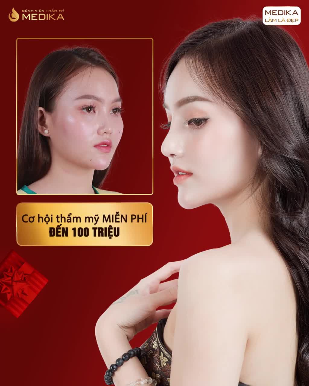THAY ĐỔI DÁNG MŨI  "LỘT XÁC" GƯƠNG MẶT