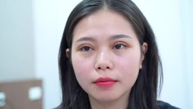 Thay đổi đến ‘chóng mặt’ của khách hàng ngay sau khi cắt mí MK tại Dr.Hải Lê sau 7 ngày. Cùng theo dõi cảm nhận của khách hàng sau thẩm mỹ