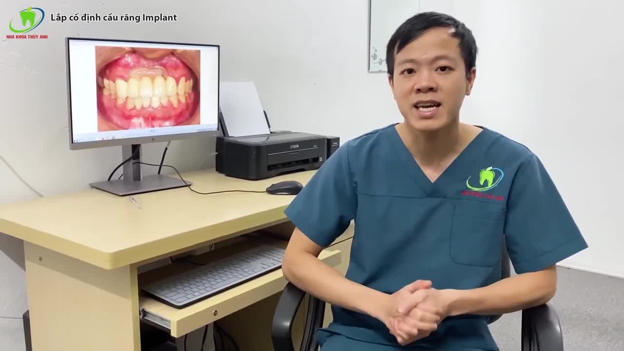 THAY THẾ CẦU 5 RĂNG SỨ BẰNG CẦU 3 RĂNG IMPLANT TRONG TRƯỜNG HỢP GẪY RĂNG CỬA