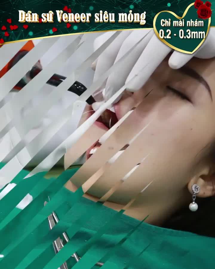 THÊM HƯƠNG CHO NHAN SẮC CHỈ BẰNG MỘT NỤ CƯỜI