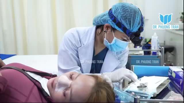 THEO CHÂN BÁC SĨ TRẦN PHƯƠNG THĂM KHÁM, THÁO NẸP CHO CÁC KHÁCH HÀNG SAU NÂNG MŨI