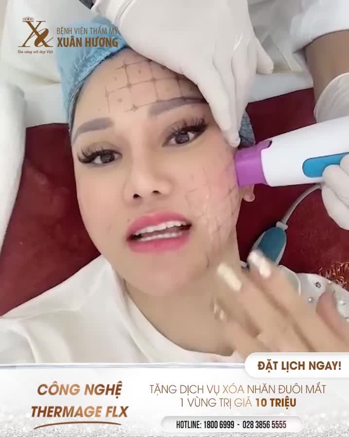 THERMAGE FLX 4.0 XÓA NHĂN NHANH CHÓNG, TRẺ HÓA TOÀN DIỆN