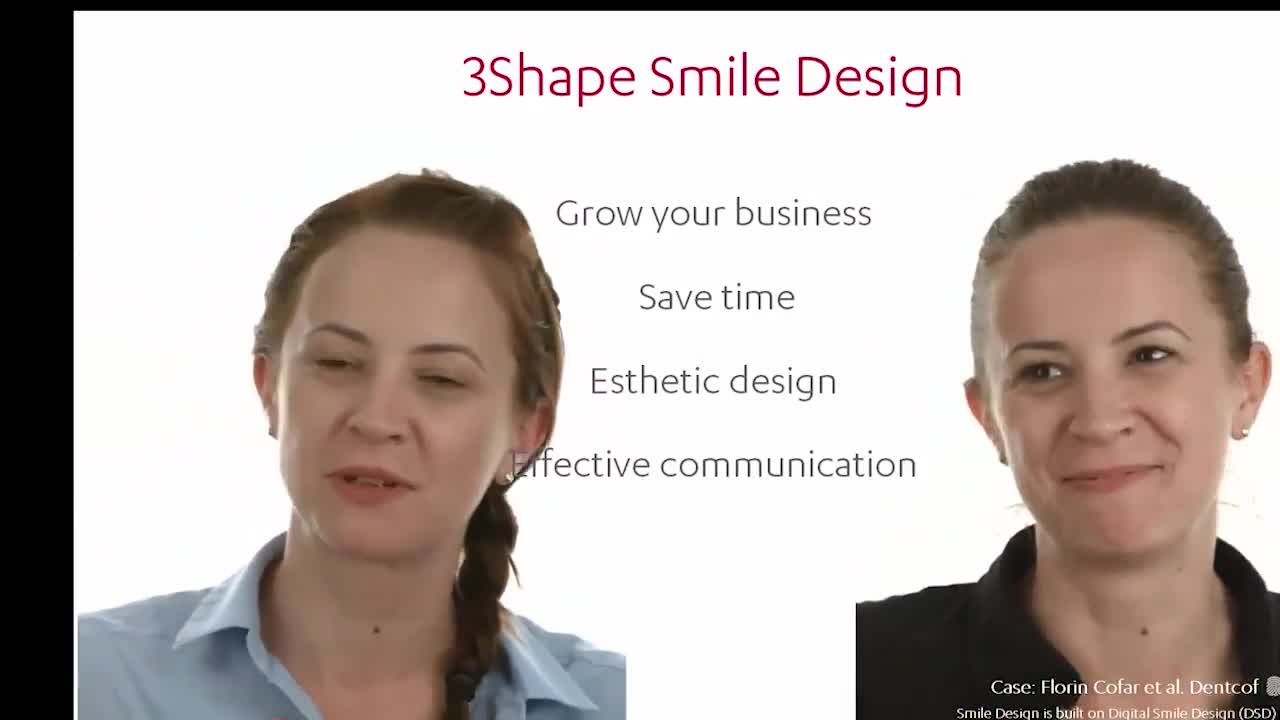 THIẾT KẾ NỤ CƯỜI - DIGITAL SMILE DESIGN - CÔNG NGHỆ THẨM MỸ 2021