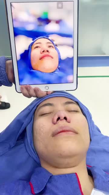 Thu nhỏ đầu mũi thay đổi diện mạo chỉ sau 30'  MŨI TO phải làm sao? Cùng bác sĩ Kangnam chia sẻ bí kíp