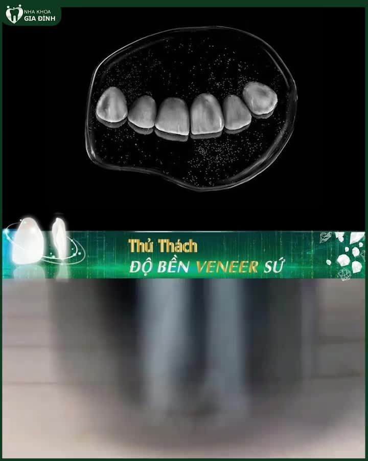 THỬ THÁCH ĐỘ BỀN CỦA MIẾNG DÁN SỨ VENEER