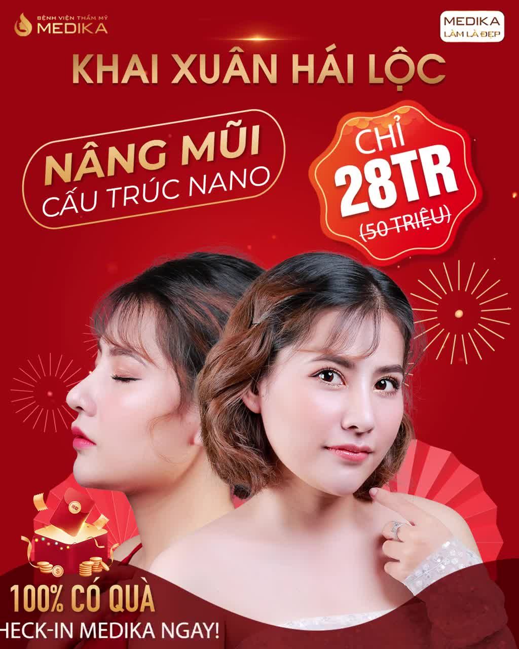 TIỄN MŨI XẤU, RINH MŨI CAO XINH, ĐẸP AN TOÀN