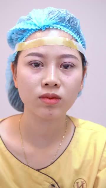 Tiếp tục giải cứu thành công ca Mí hỏng do thực hiện tại cơ sở không uy tín