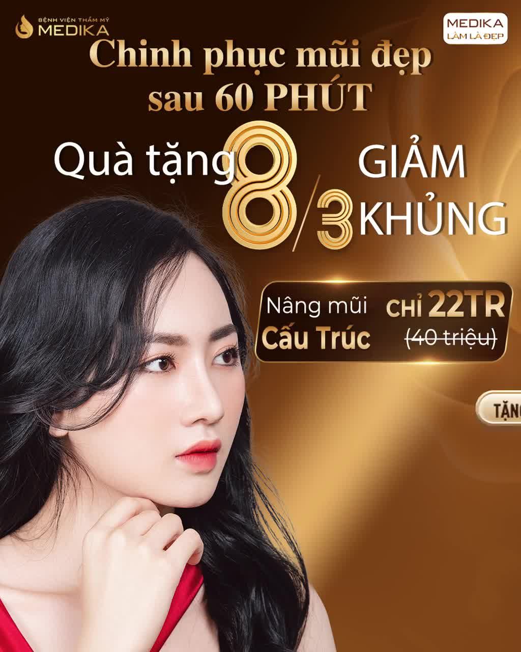 TIẾT KIỆM 45% NÂNG MŨI CẤU TRÚC CHỈ 22 TRIỆU THẬT KHÔNG THỂ TIN NỔI - TIẾT KIỆM 45% KHI CHỌN NÂNG MŨI CẤU TRÚC
