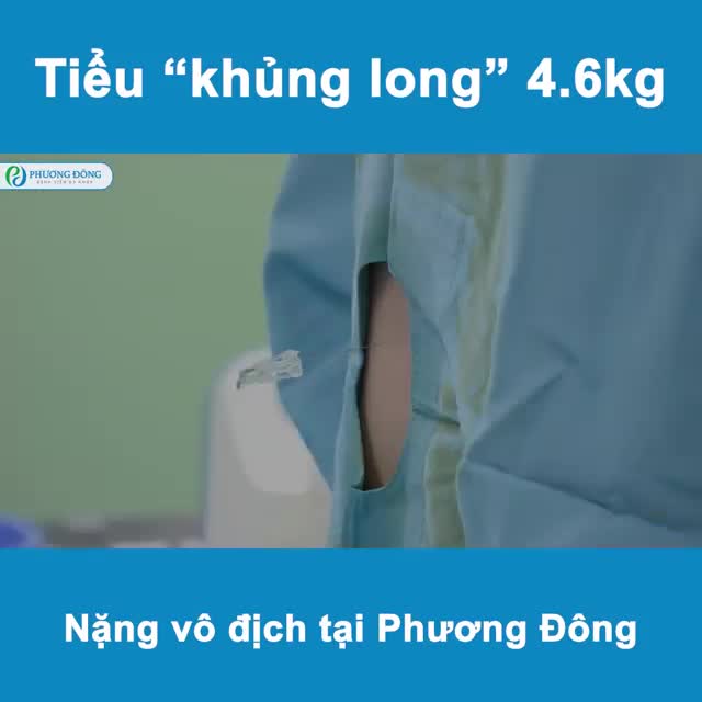Tiểu "Khủng Long" 4,6kg