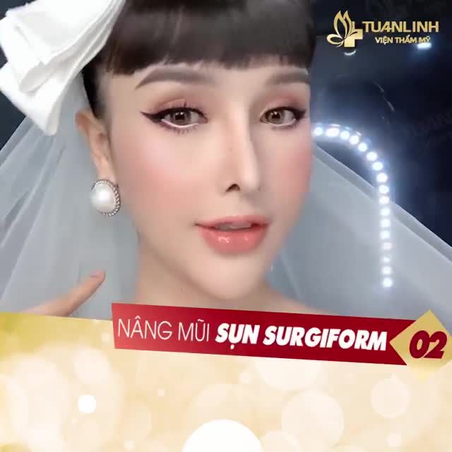 TOP 3 XU HƯỚNG NÂNG MŨI ĐANG LÀM MƯA LÀM GIÓ HIỆN NAY