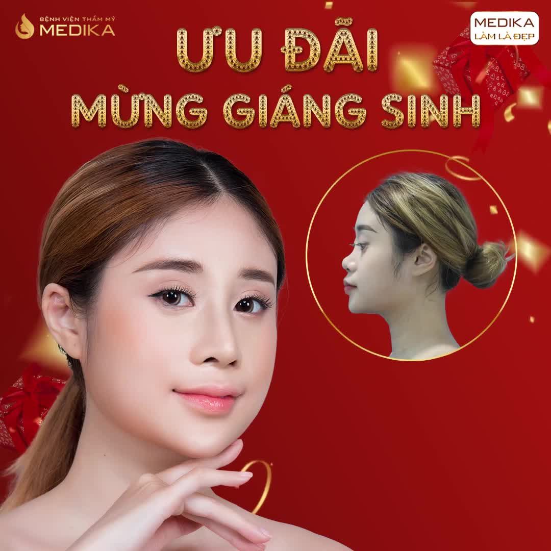 TRẢI NGHIỆM 1 LẦN  CÓ NGAY MŨI ĐẸP