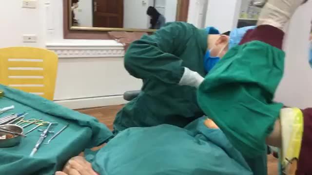 Trồng chân răng nhân tạo implant, khôi phục vị trí răng 46 bị mất cho Anh Tùng tại nha khoa Thùy Anh.