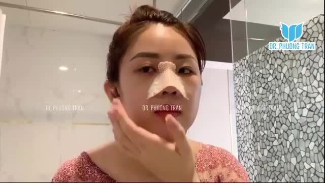 TỰ VỆ SINH MŨI Ở NHÀ CÓ KHÓ KHĂN LẮM KHÔNG?