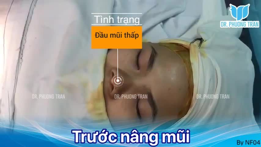 “Tưởng không đẹp ai ngờ đẹp không tưởng”