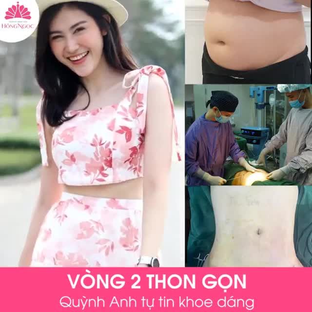 VÒNG 2 THON GỌN - QUỲNH ANH TỰ TIN KHOE DÁNG