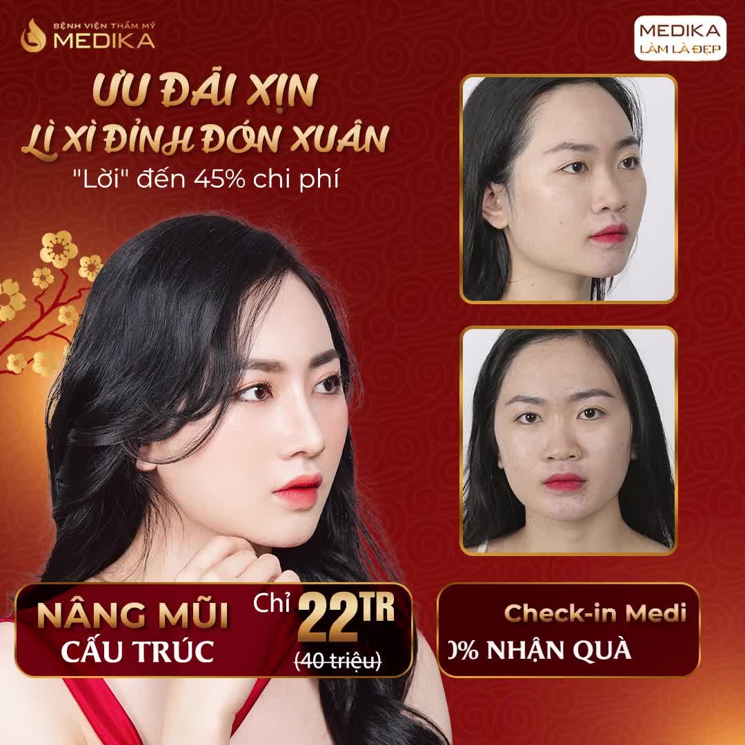 XỈU LÊN XỈU XUỐNG VỚI MÀN "LỘT XÁC" CỦA YẾN NHI SAU NÂNG MŨI CẤU TRÚC