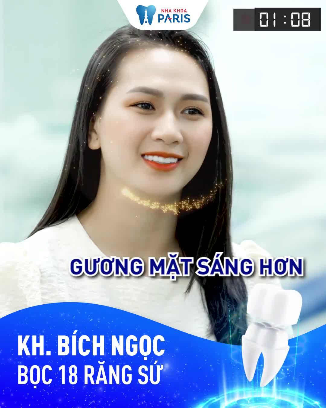 1 Năm Sau Bọc Răng Sứ Sẽ như thế nào