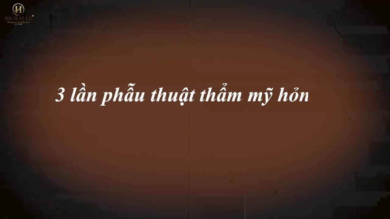 3 năm trầm cảm, tuyệt vọng vì bị nhiều cơ sở thẩm mỹ từ chối sửa