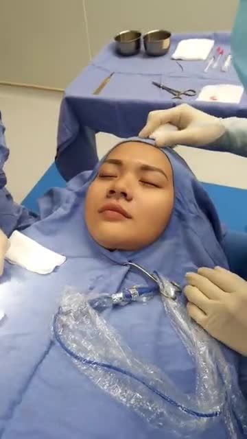 30 phút THU GỌN CÁNH MŨI cùng bác sĩ Kangnam Chứng kiến Sự thay đổi ngoạn mục giữa cánh mũi trước và sau khi phẫu thuật