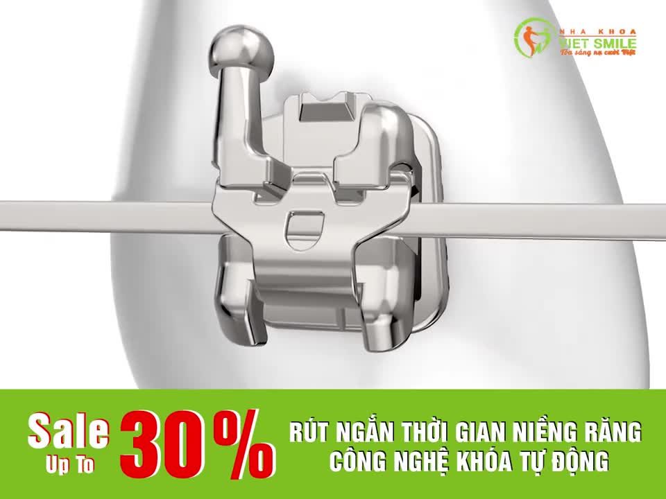 85% KHÁCH HÀNG CHỌN KIM LOẠI TỰ ĐỘNG