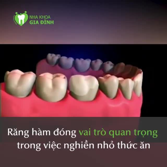 AI ĐANG HỎNG RĂNG HÀM XEM VIDEO NÀY ĐỂ CHỌN LOẠI RĂNG SỨ PHÙ HỢP NHÉ!