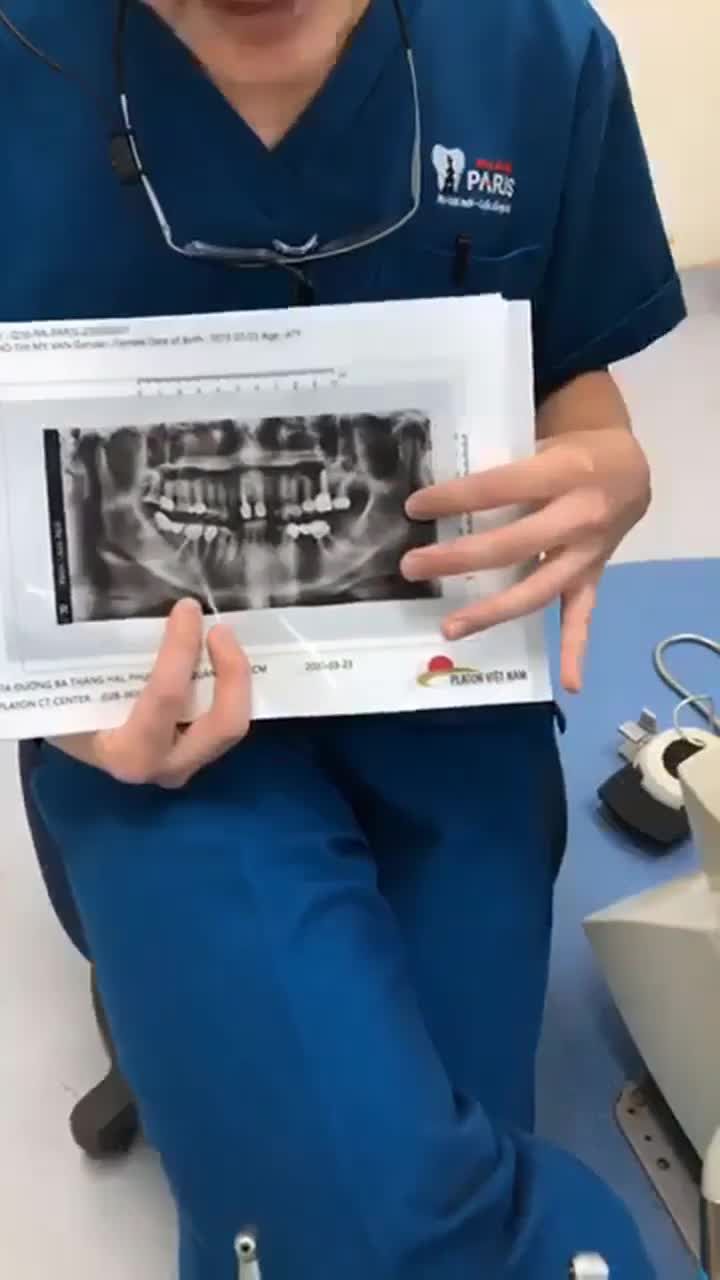 Bác sỹ phân tích phác đồ cấy ghép Implant
