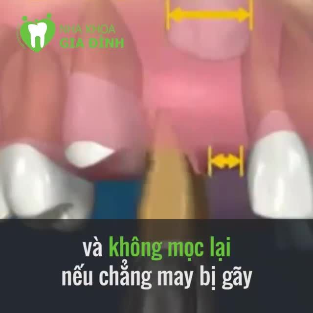 BẠN CÓ BIẾT, KHI MẤT RĂNG TA CÓ THỂ GIÀ ĐI 20 TUỔI