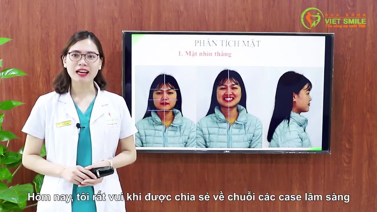 Bạn khách hàng tìm đến Viet Smile trong tình trạng