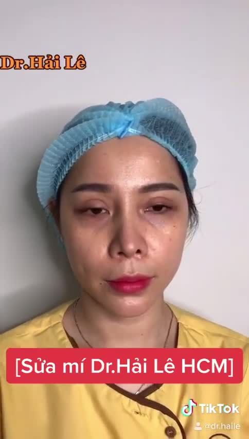Bạn ở khu vực phía Nam đang lo lắng tìm nơi Sửa mí hỏng do thực hiện tại cơ sở thiếu uy tín?