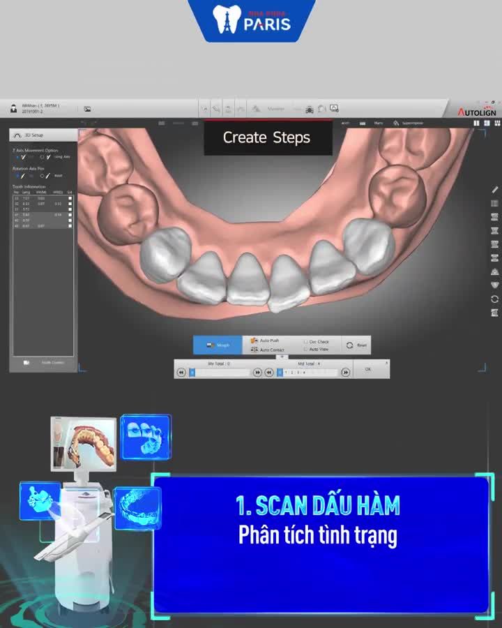 Bộ đôi công nghệ Niềng răng 4.0
