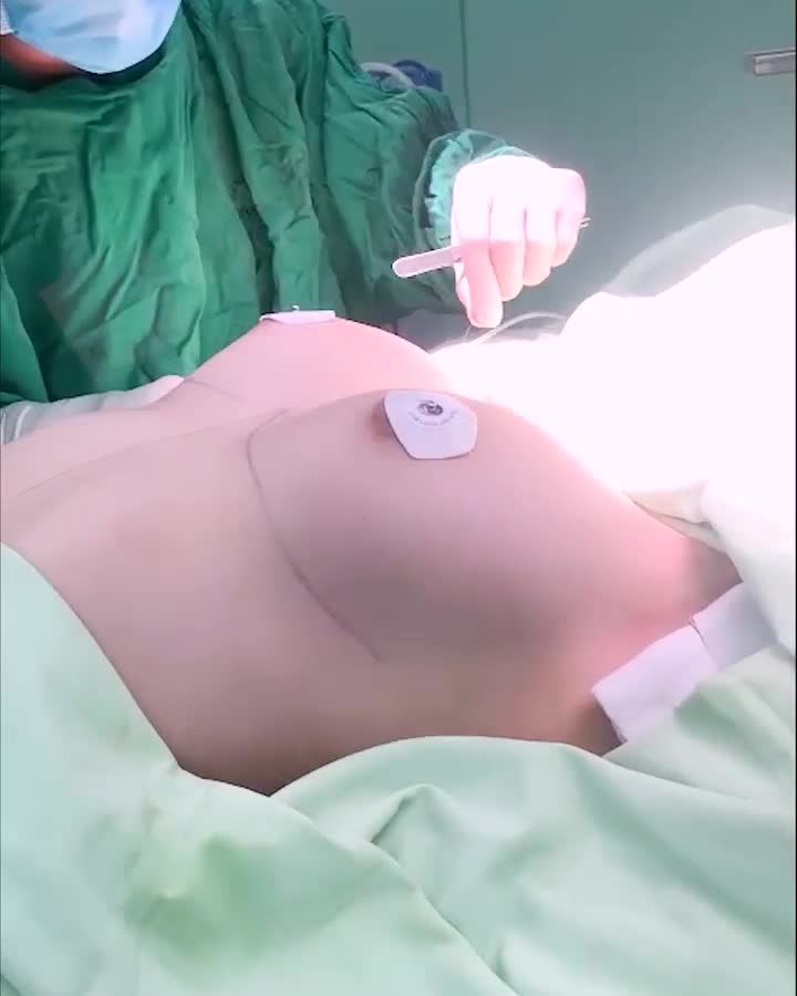 BỎNG MẮT VỚI V1 CĂN TRÒN SAU 45 PHÚT