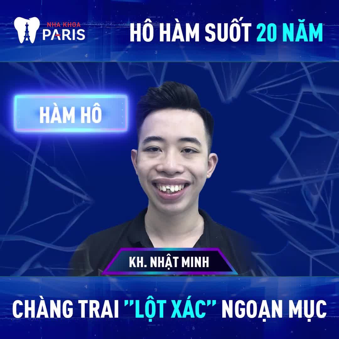 "Bye bye" HÀM HÔ - CẰM LẸM - MÔI LỆCH