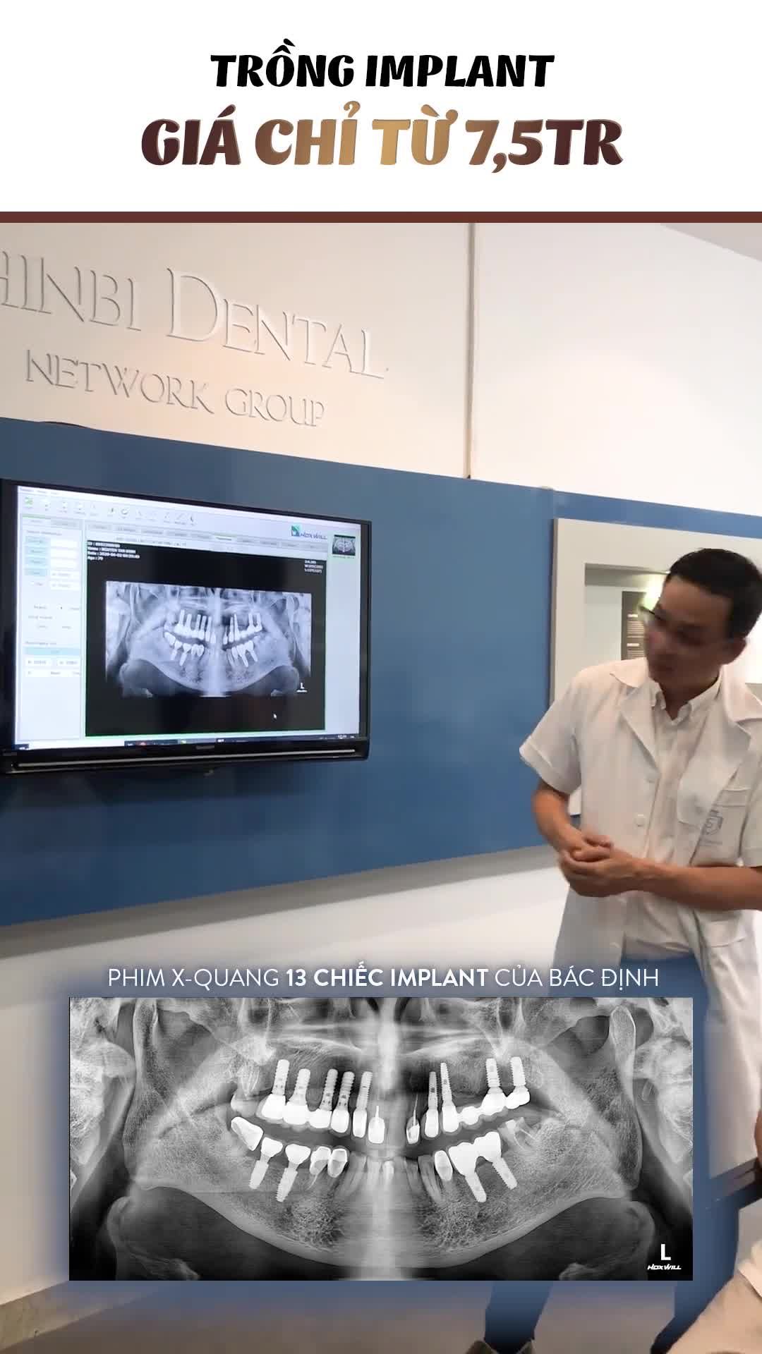 Ca cắm Implant "KINH ĐIỂN" tại Shinbi