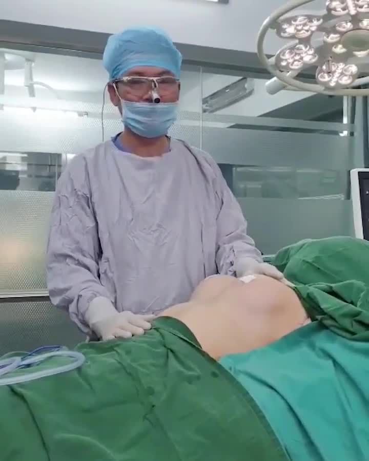 CA CHỈNH SỬA NÂNG CẤP V1 ĐÃ TỪNG TIÊM FILLER.