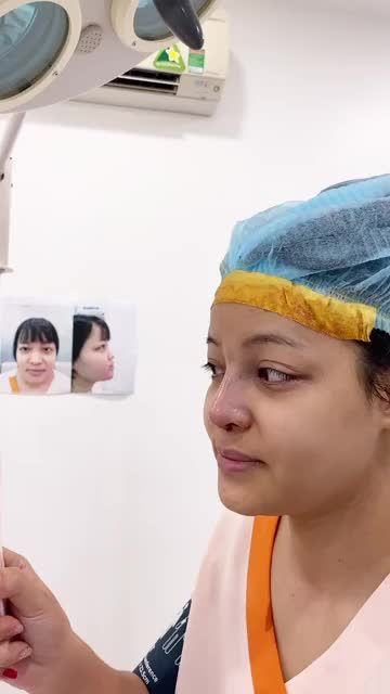 CA NÂNG MŨI CUỐI NGÀY TẠI AZ NOSE