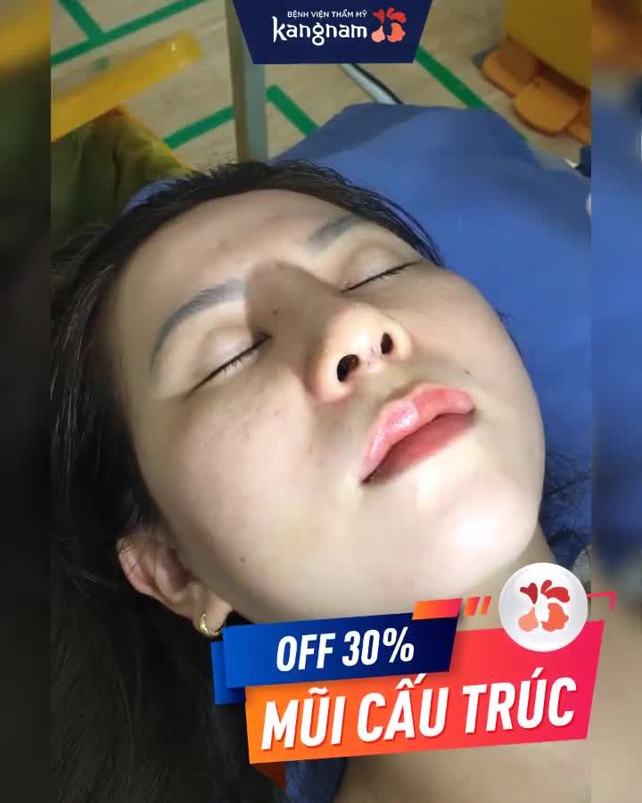 Cận cảnh Cắt chỉ mũi "nhẹ nhàng như muỗi" - Không sẹo