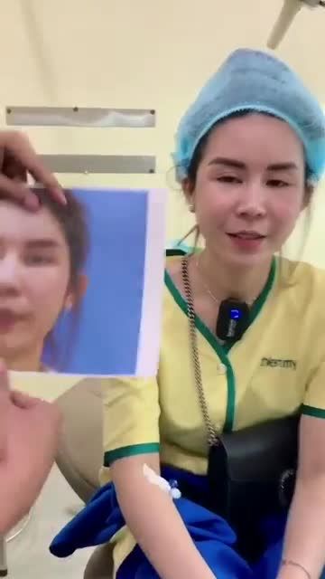 Cận cảnh Khách hàng đã từng nâng mũi 4S 2 lớp tại Thiện Mỹ, nay lại tới để cắt mắt.
