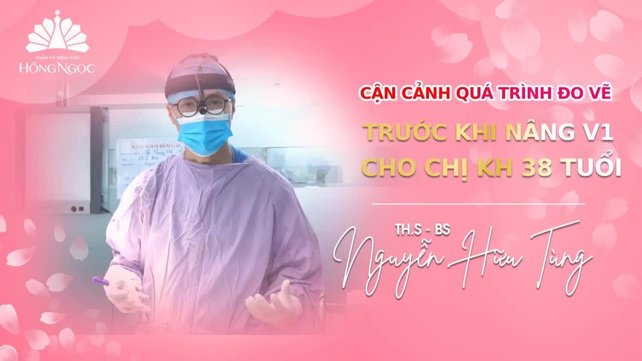 CẬN CẢNH QUÁ TRÌNH ĐO VẼ TRƯỚC THỀM NÂNG V1 CHO CHỊ KH 38 TUỔI