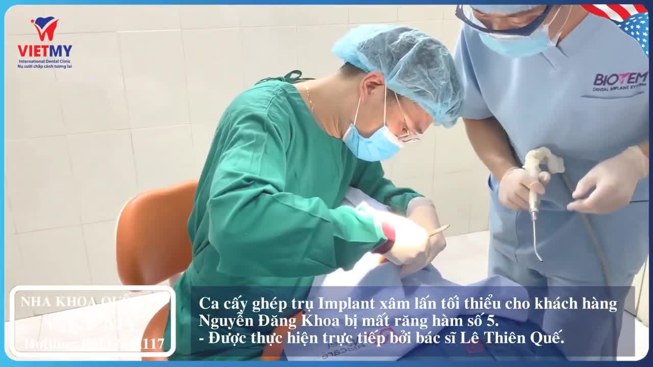 Case cấy ghép Implant cho khách hàng bị mất răng hàm ăn nhai số 5