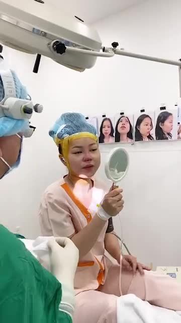 Case mũi cấu trúc sửa lại cho khách hàng đã từng nâng sụn nhân tạo