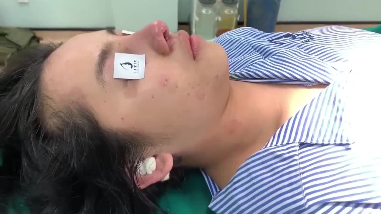 Case mũi cấu trúc sửa lại lần 3 vừa có kết quả đây cả nhà mình ơi.