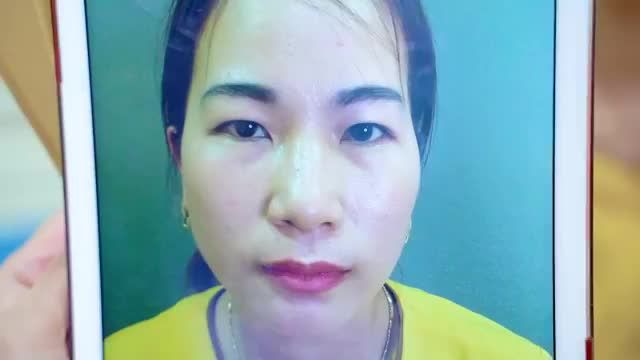"Cắt mí không đau, chịu đựng được, nhẹ nhàng lắm chị em cứ tự tin đi làm mí để trẻ trung hơn nhé"