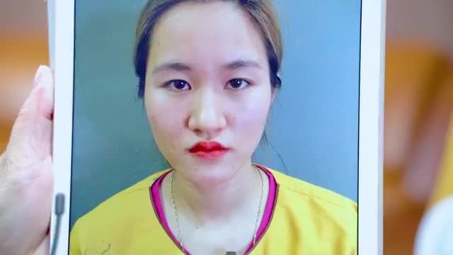 Cắt mí vừa thực hiện xong cứ đẹp tự nhiên quá vậy thì lại làm cho người xem livestream "nghiện" chỉ muốn đến Dr.Hải Lê làm mí ngay thôi