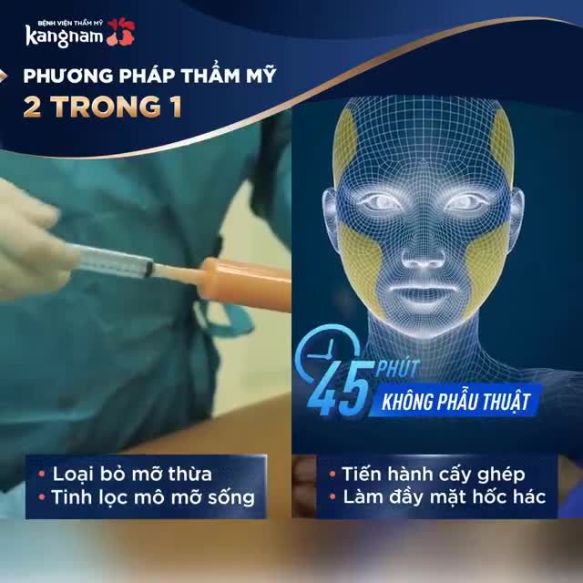 Cấy mỡ Nanofat - Lấy mỡ chỗ thừa làm đầy chỗ thiếu